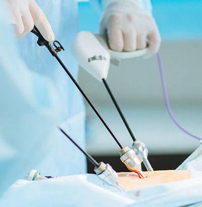 Laparoscopic and laser Surgery Laparoscopic and laser Surgery